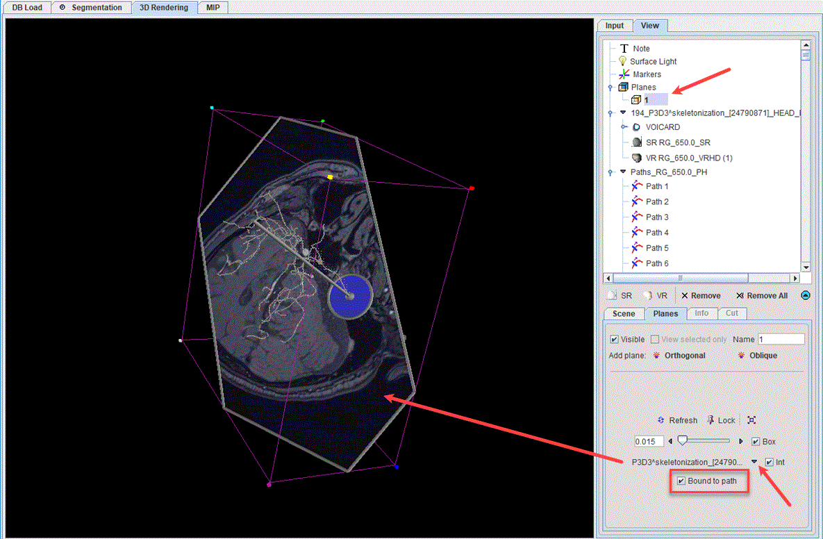 P3D_TextureObliquePlanePaths