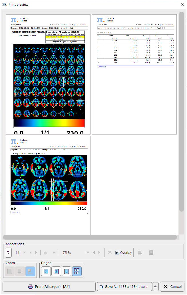 ResultDocumentation_SimplifiedMode