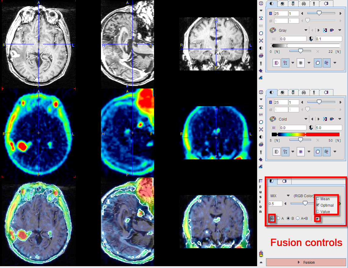 Fusion Separate Sources