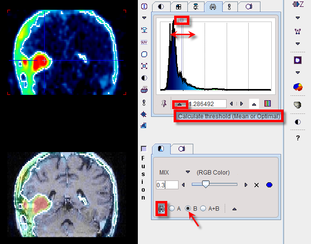 Fusion Iso-Contour