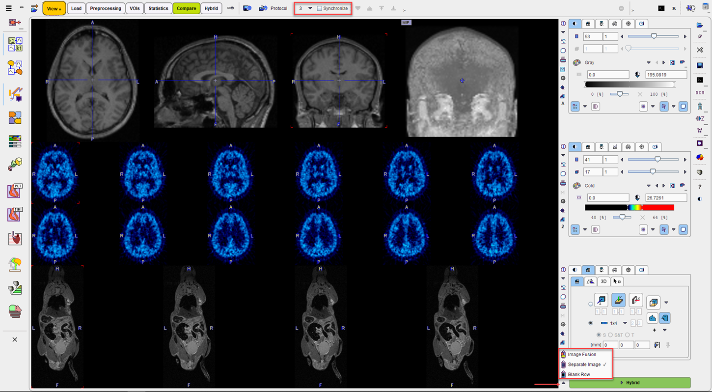 PVIEW Compare