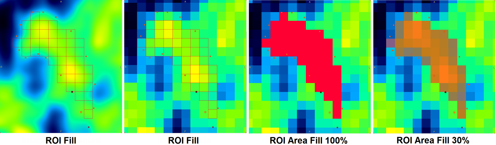 ROI Filling