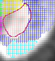 VOI Contours and Template