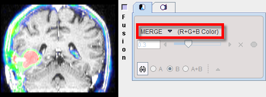 Fusion Merged