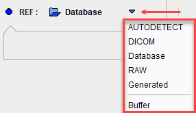 MFB Example