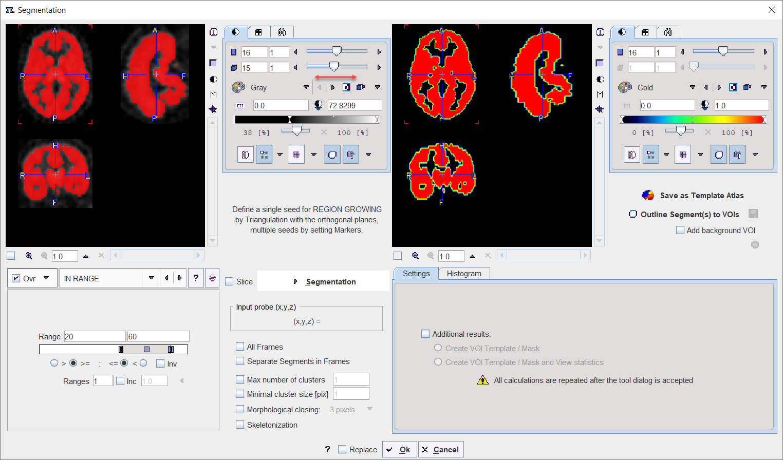 External Tool Segmentation