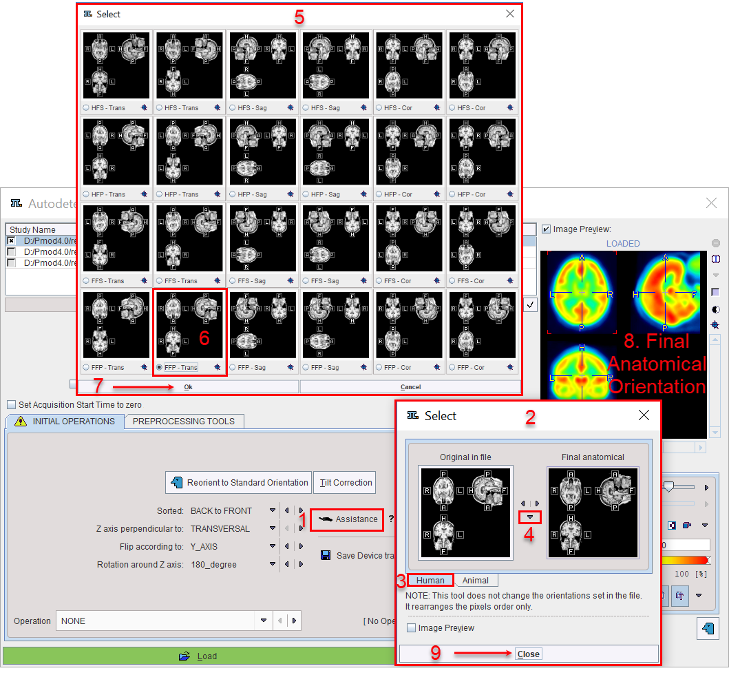 Assistance Re-orientation to Anatomical