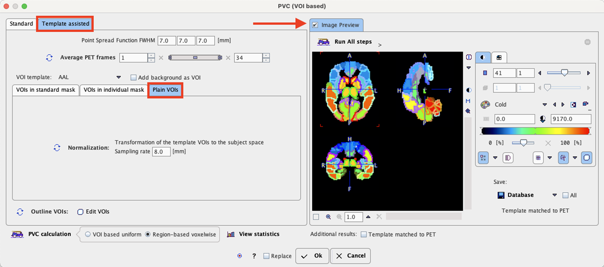 PVC using Template VOIs based on Plain VOIs