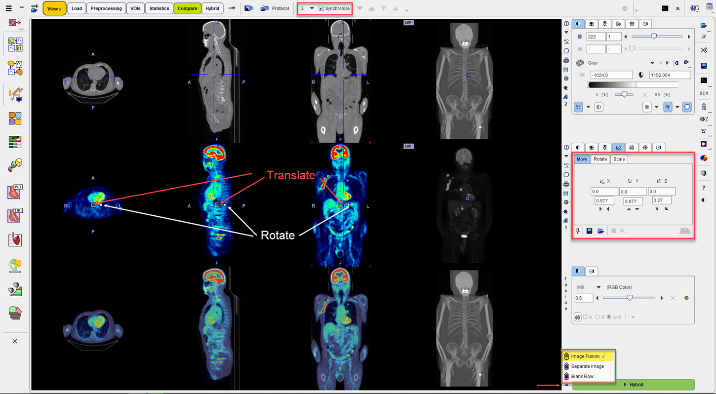 PET/CT Fusion image