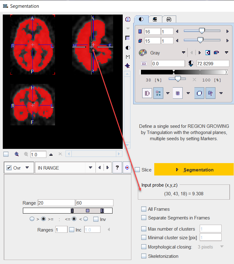 SegmentationInputProbe