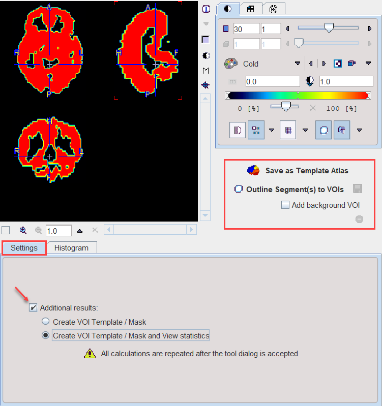 SegmentationResutSave