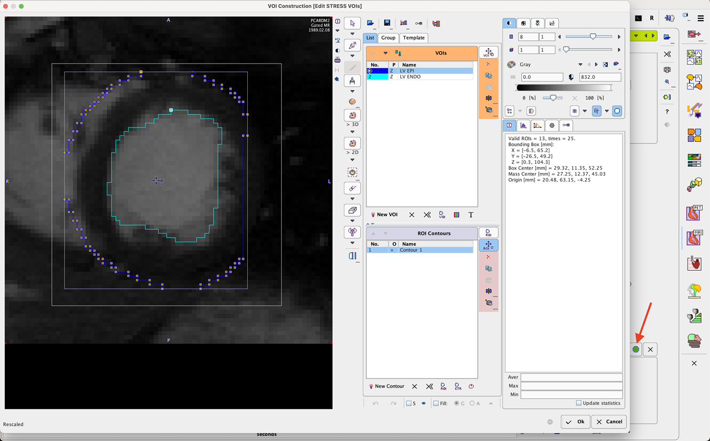 ContoursEditionDialog