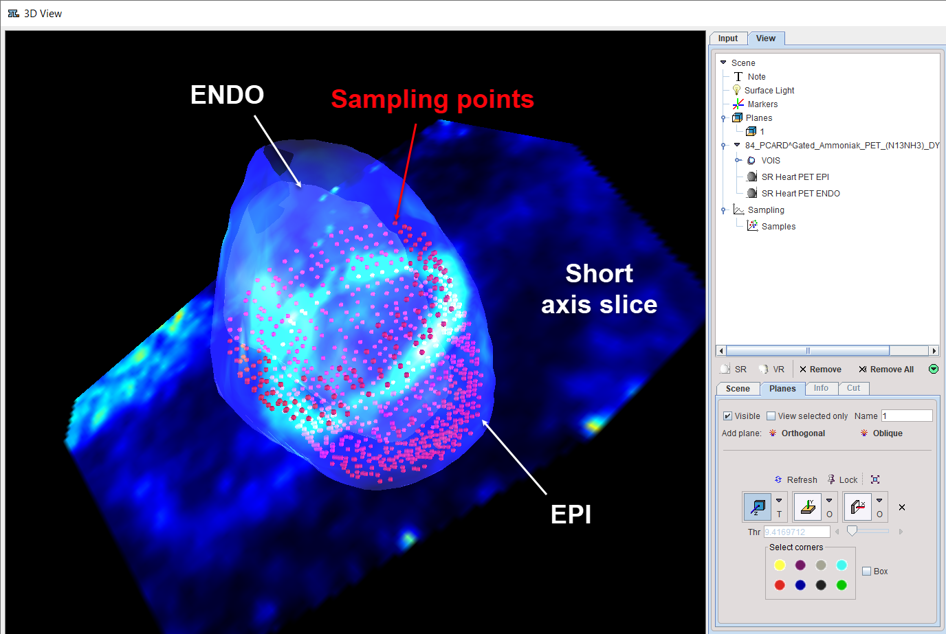 Gated3DSamplingPoints