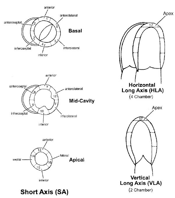 PCARD 17-Segment Model Anatomical