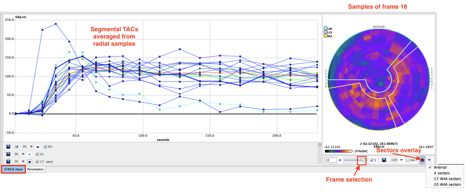 PCARD Radial Sampling Polar Plot