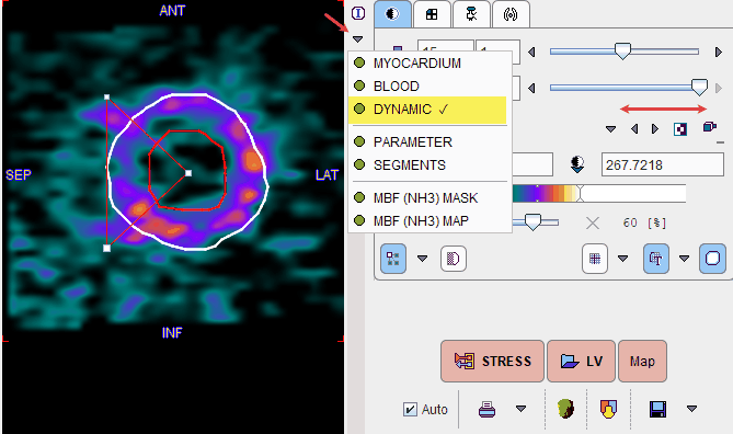 PCARD Dynamic Resampled