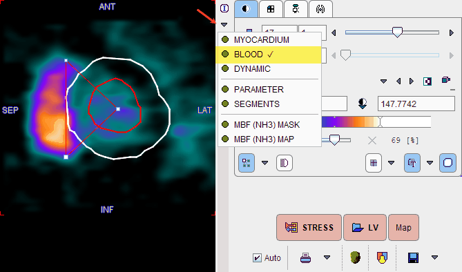 PCARD Blood Resampled