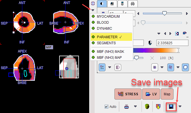 PCARD Parameters Resampled