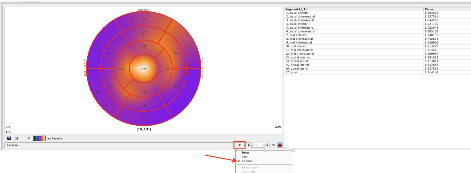 PCARD Polar Plot Selection