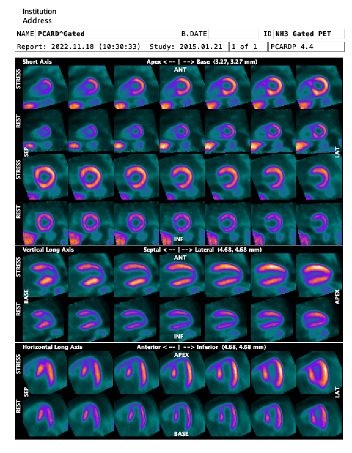 GatedCardiologicalReport