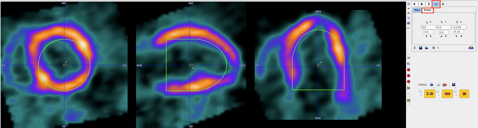 ResultStandardHeartInitialOrientation