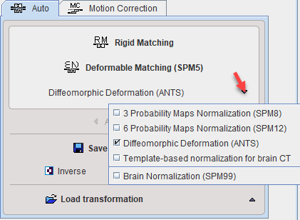 TabAutomaticMatching