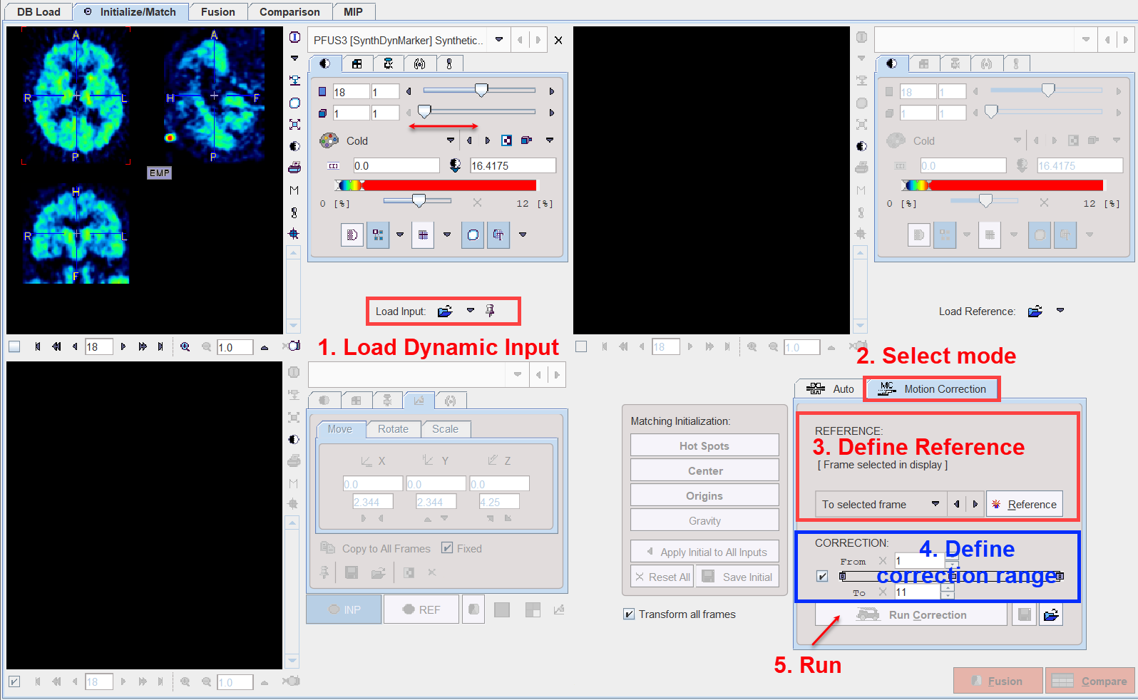 Motion Correction 1