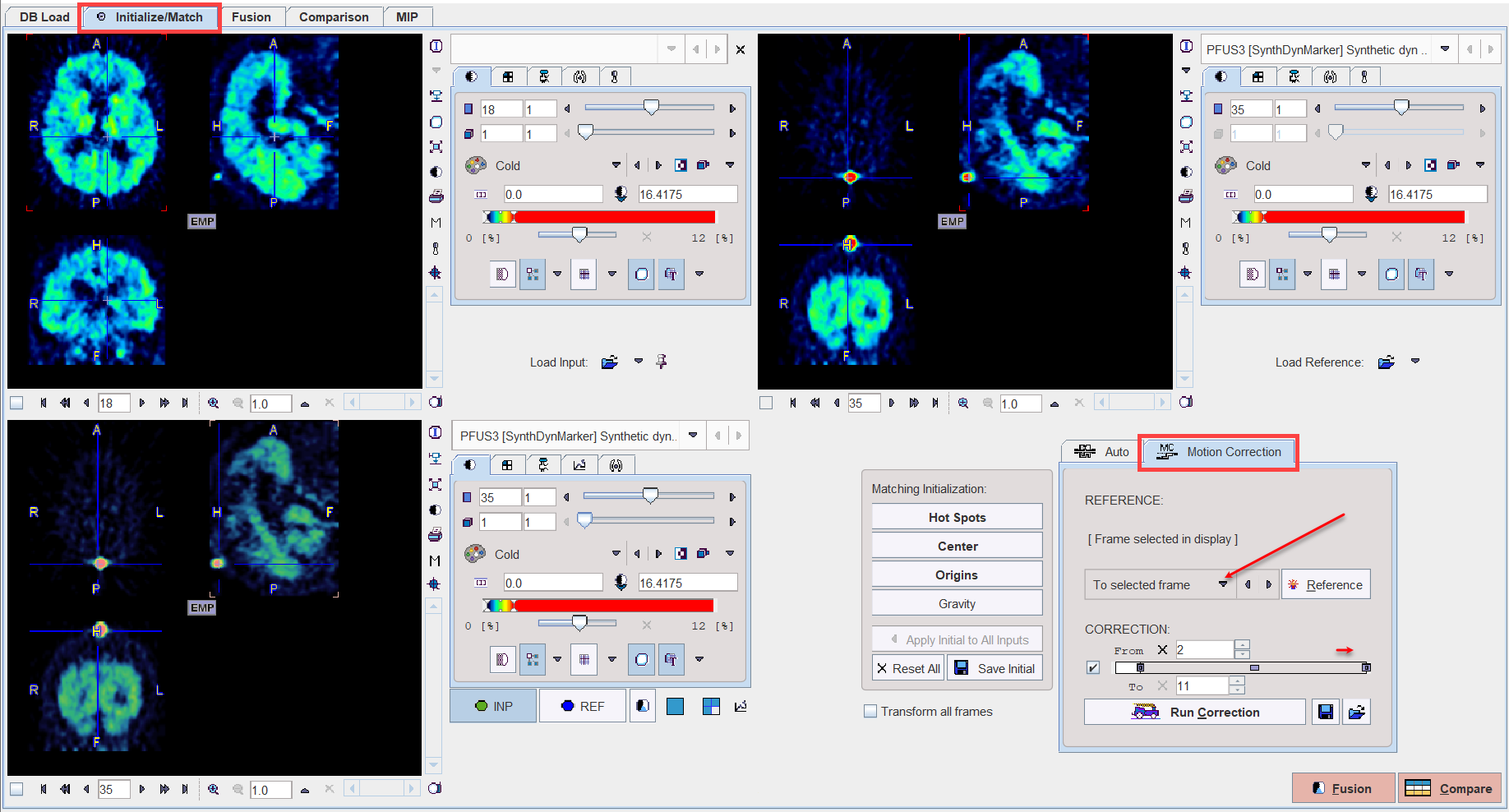 Result of Motion Correction