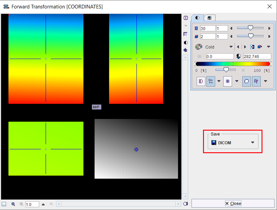 DeformationFieldViewSave