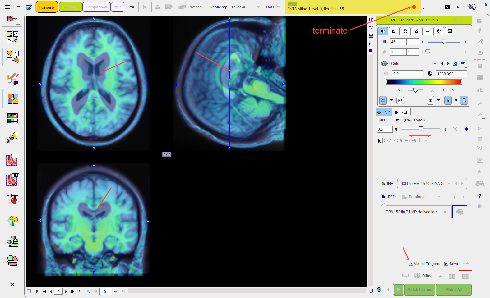 VisualProgress