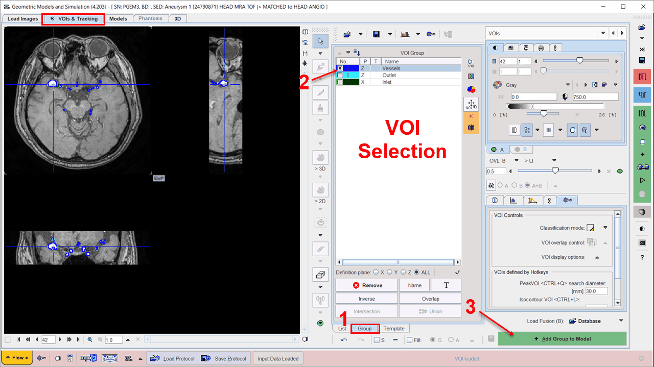 PGEMAddVOI2Model