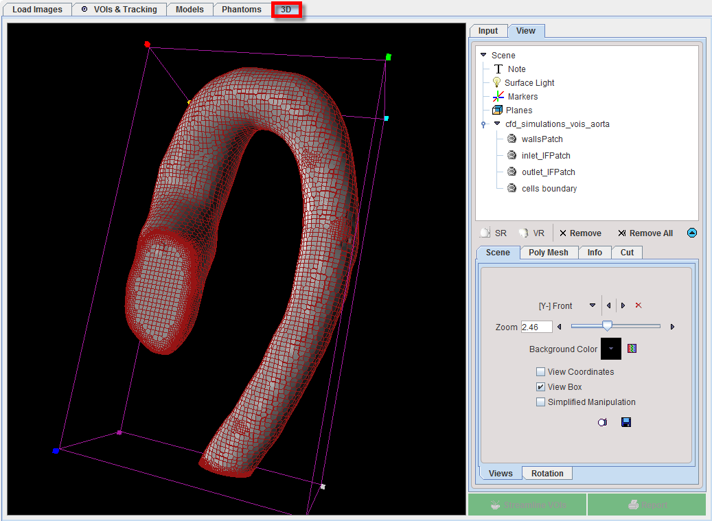 PGEMViewCaseLinkedOnModelTree