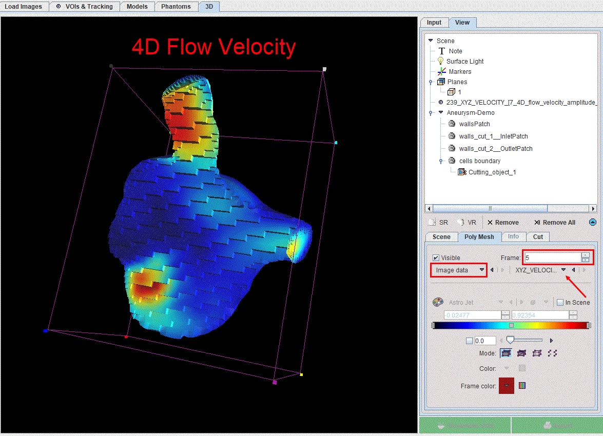 CFDResults-4DFlow3D