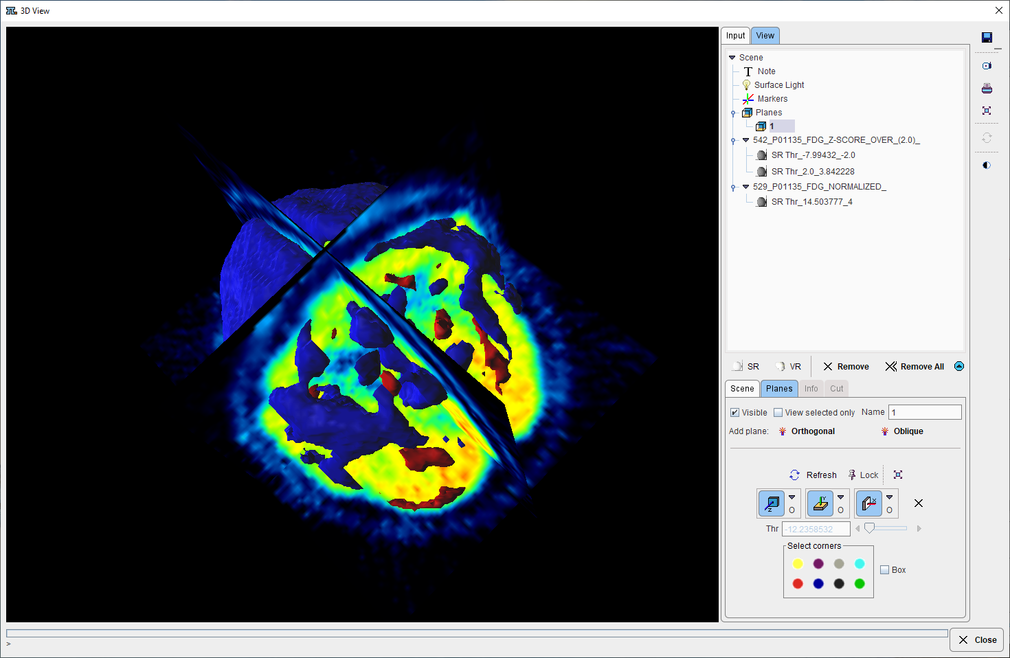 3D Rendering BrainDB