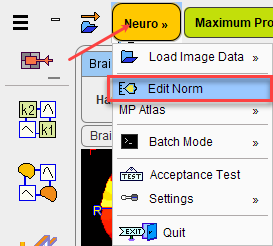 Normals Database Creation (1)