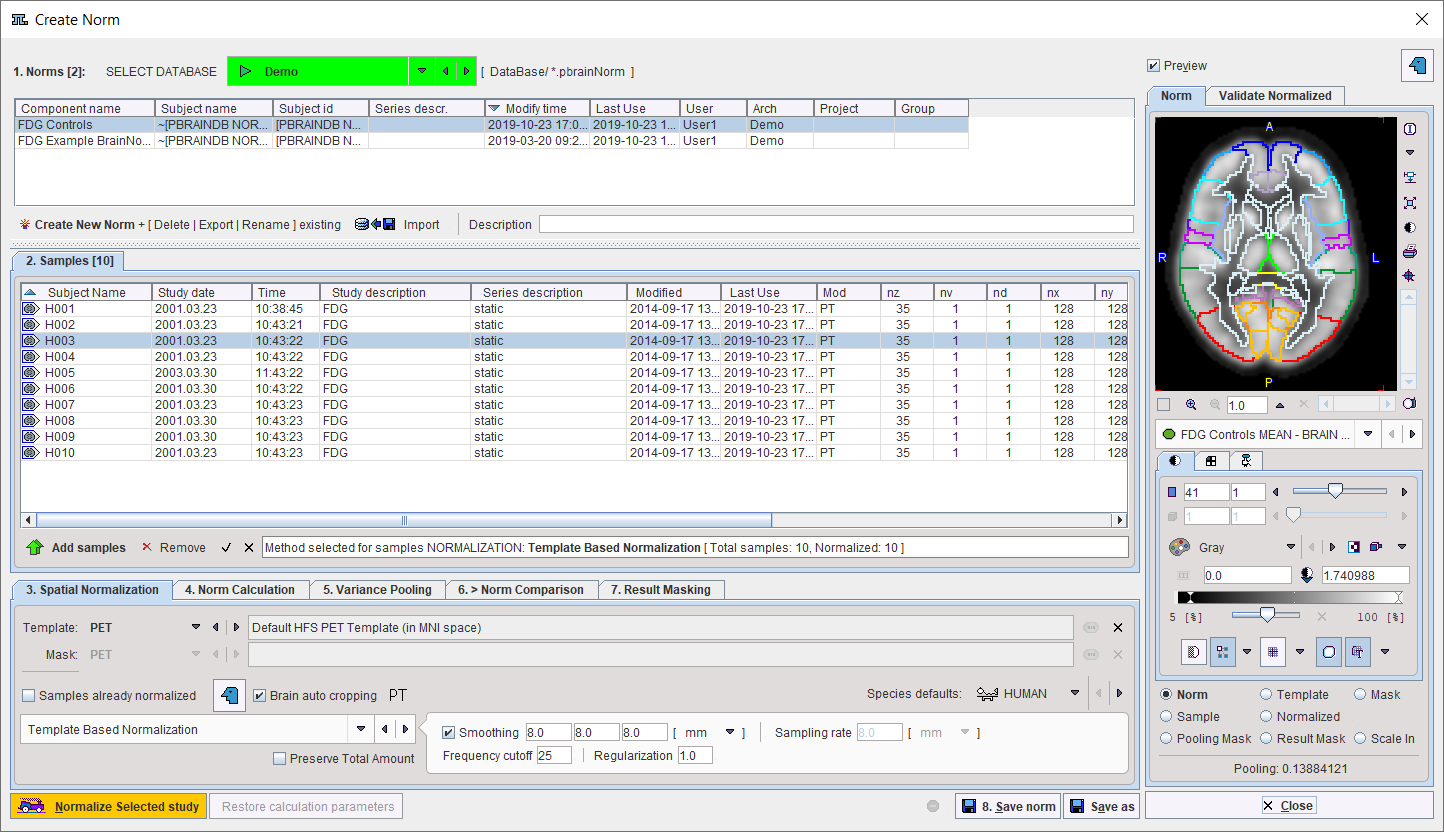 Brain DB Editor User Interface