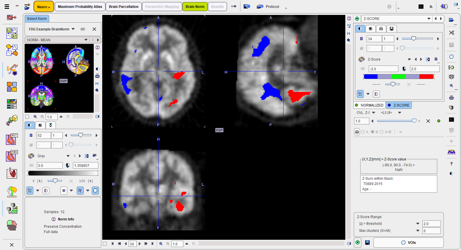 C2NPFUS1Example