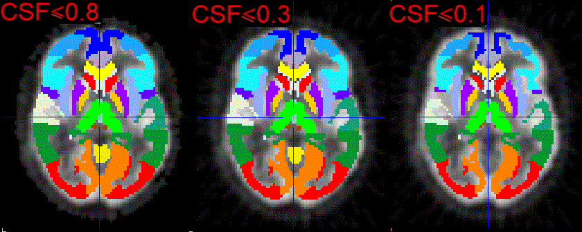 Outlining of teh Brain Structures (10) bis