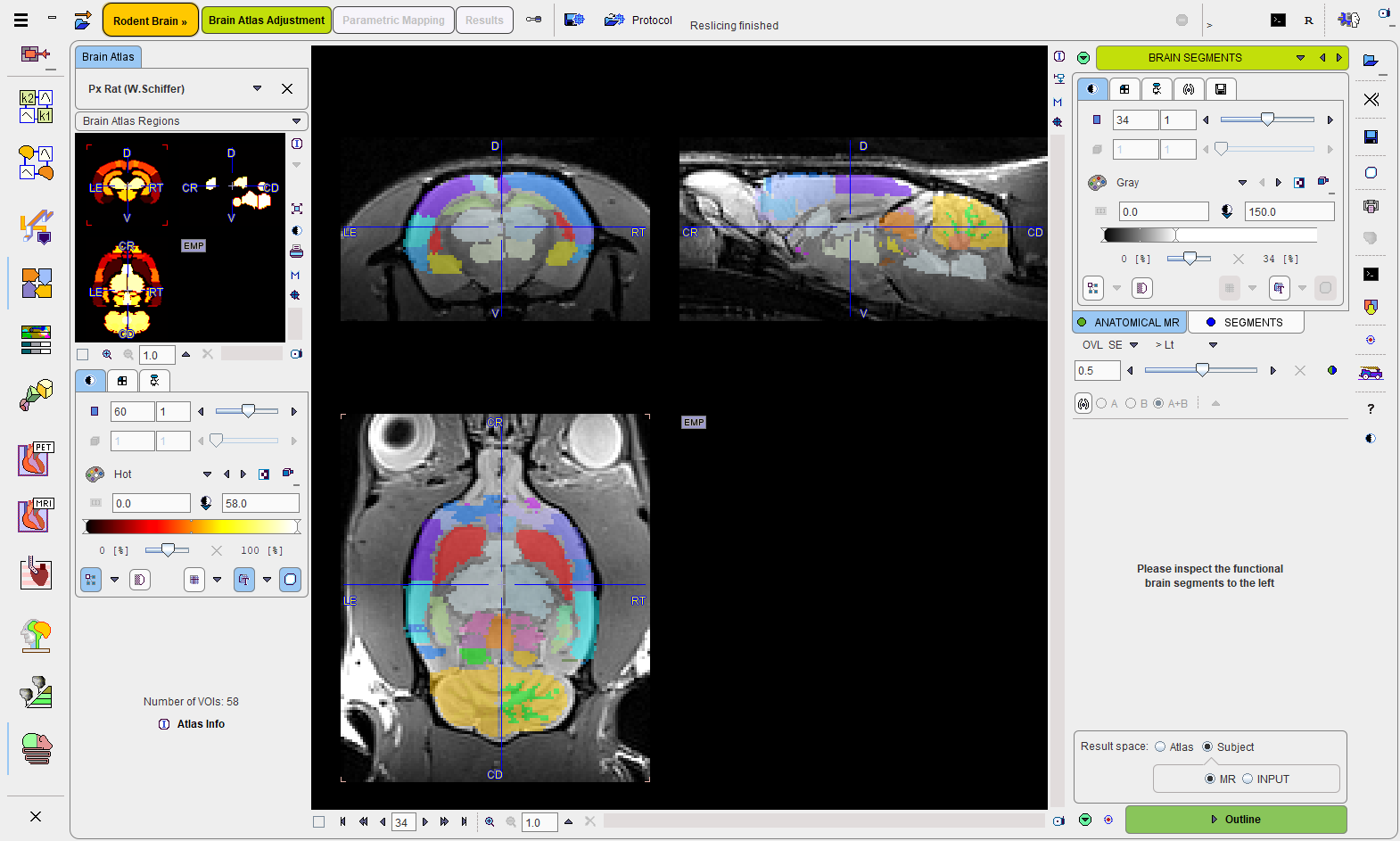 BrainSegments