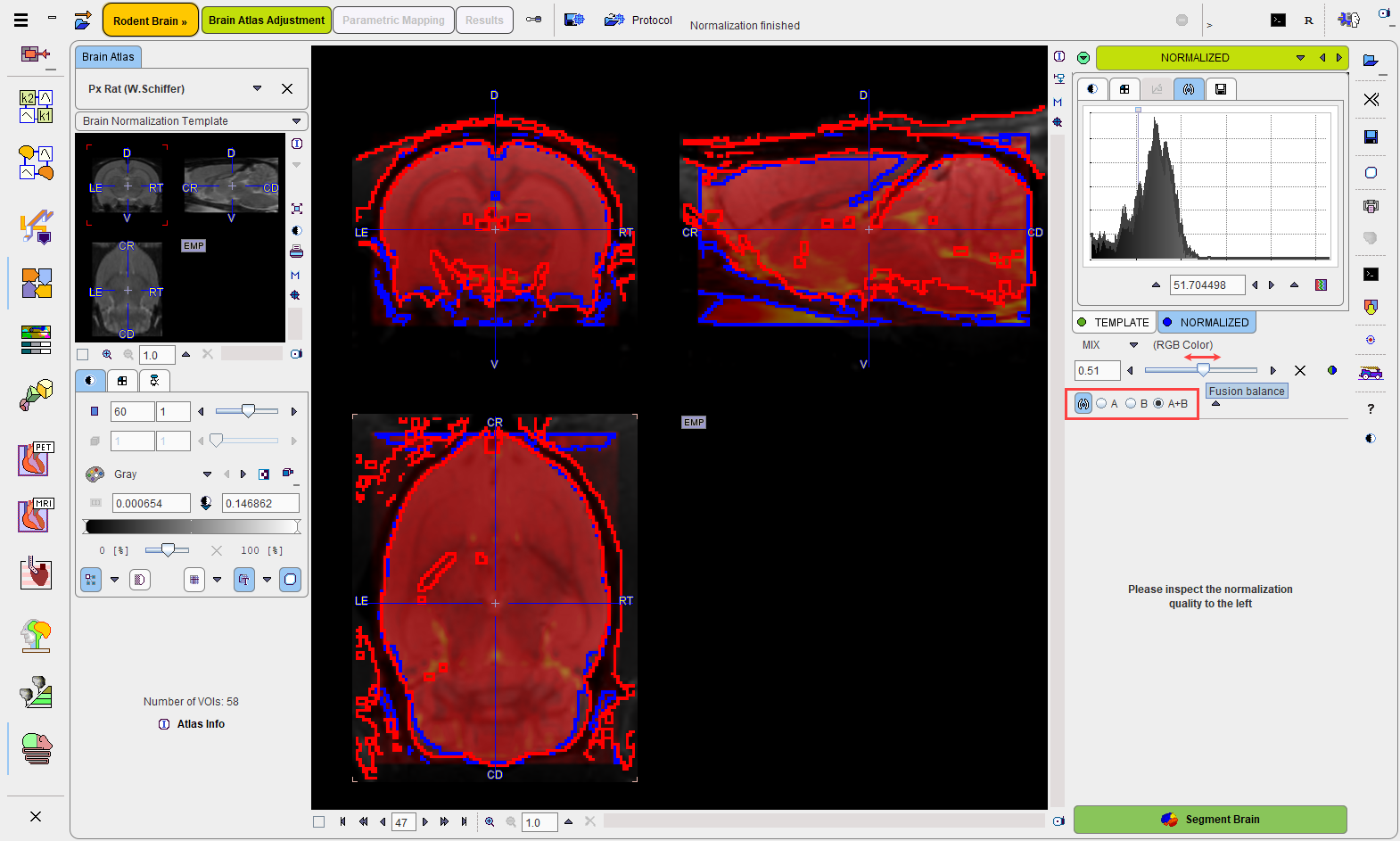 NormalizationResult1