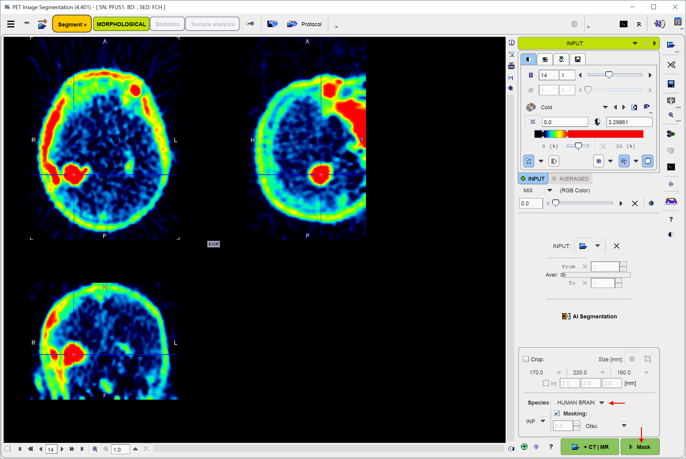 MorphologicalImageLoading