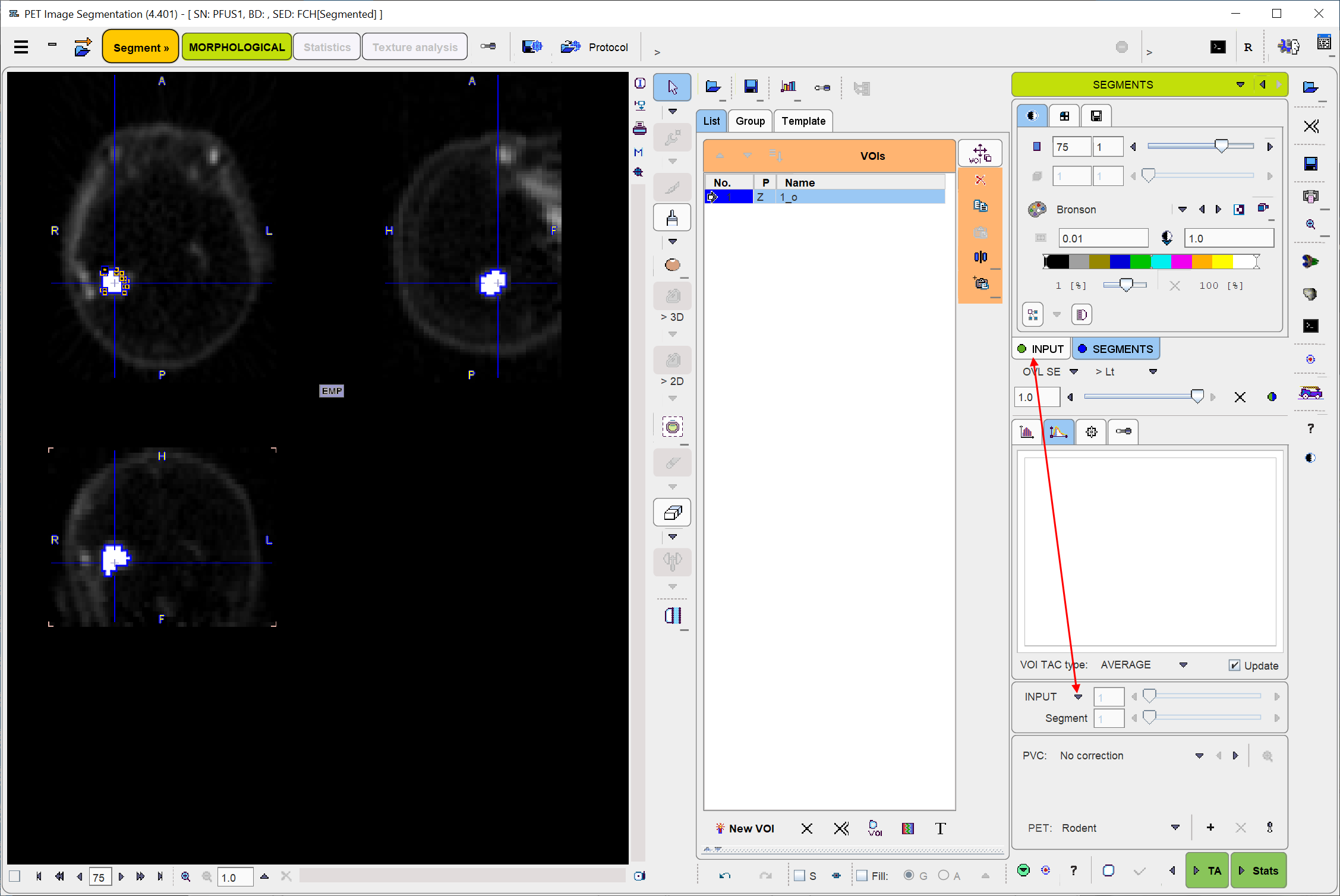 MorphologicalSegmentationResults